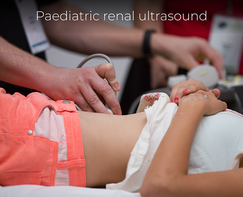 Paediatric Renal Ultrasound Worksheet