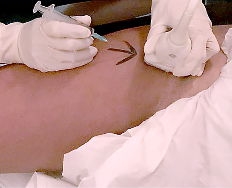 FAQ  – MSK ultrasound-guided injections